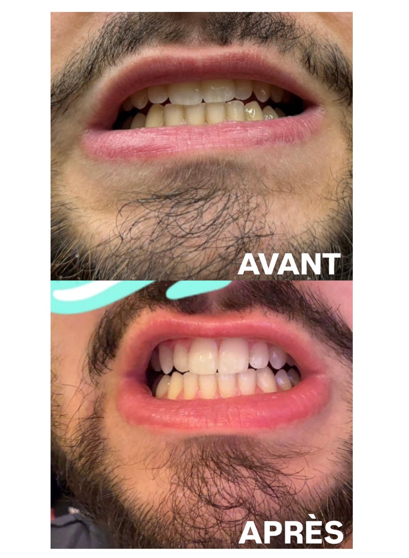 PRÉCOMMANDE PALMCARE WHITENING+