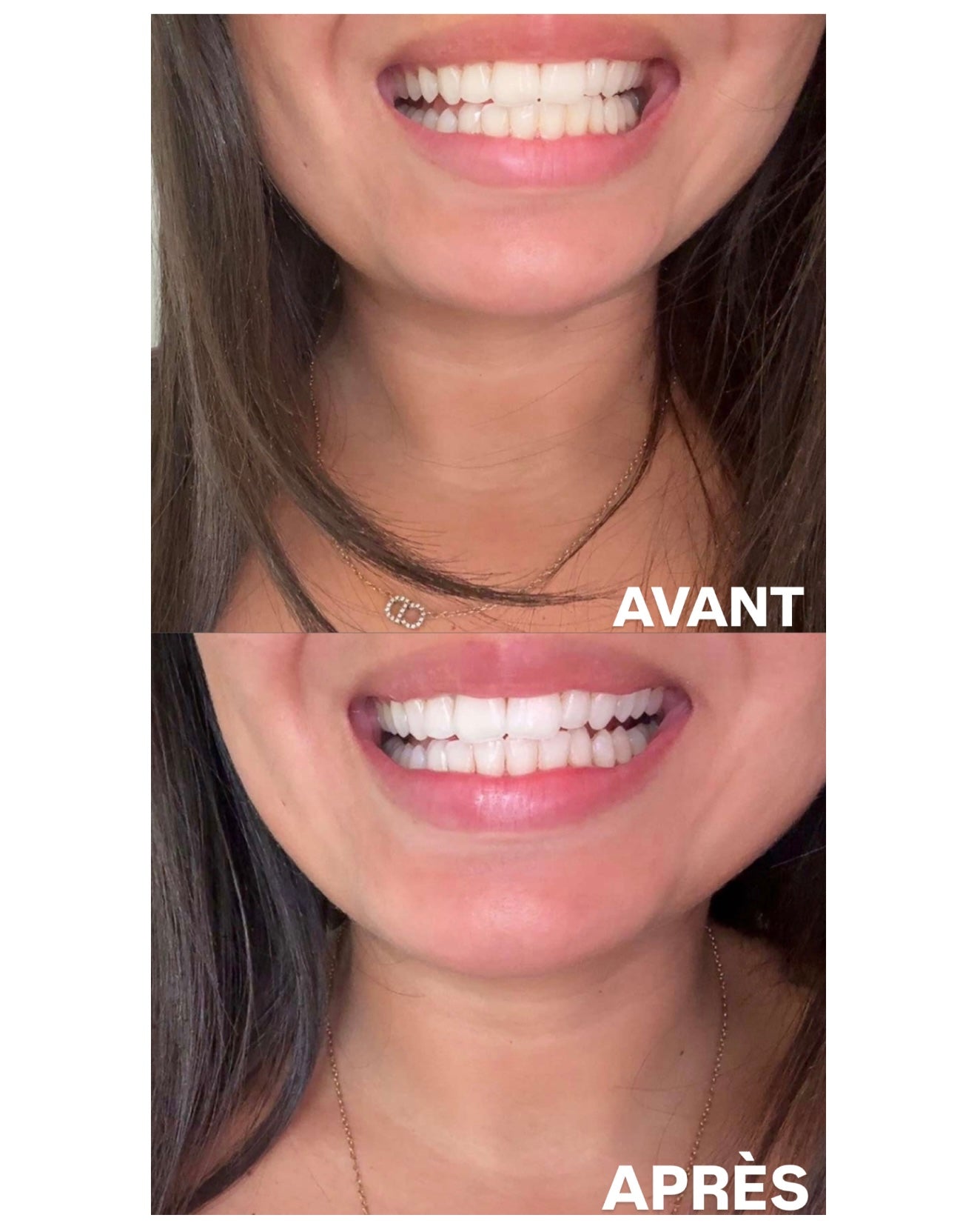 PRÉCOMMANDE PALMCARE WHITENING+